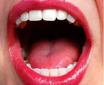 Your tongue is germ free only if it is pink